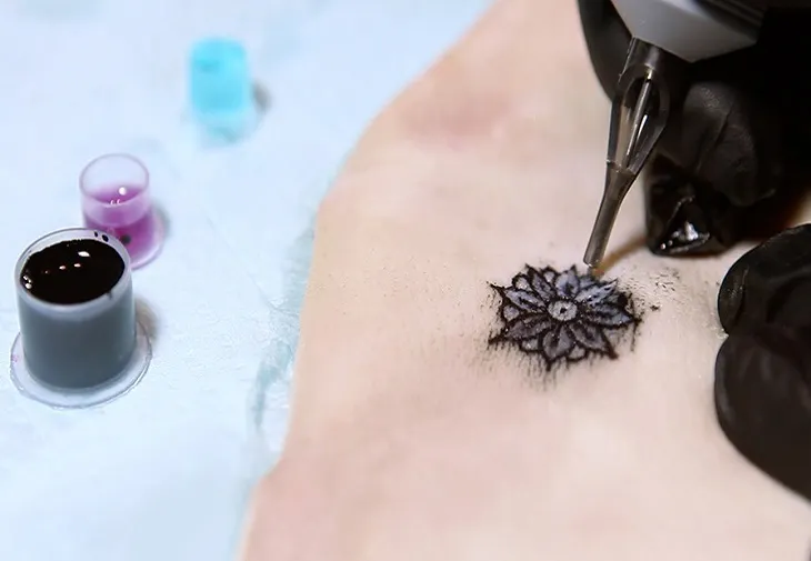 Tatuaj care își schimbă culoarea în funcție de nivelul glicemiei