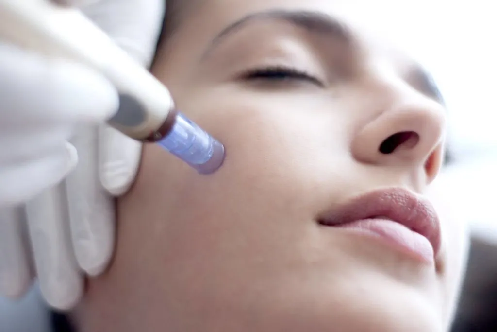 Cum funcționează dermapenul, „stiloul” dermatologiei care înlătură problemele pielii