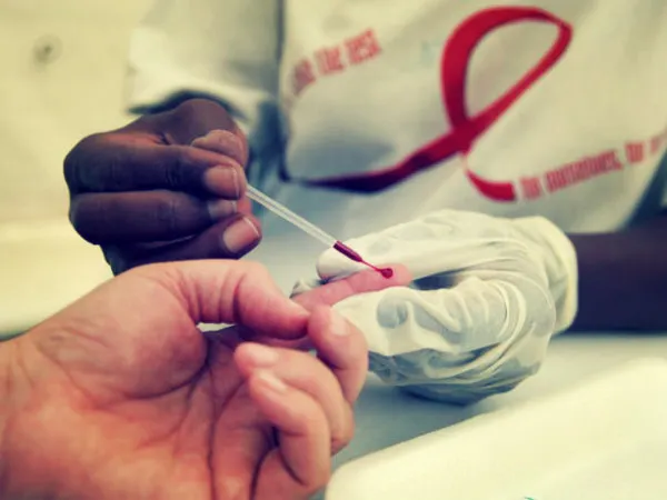 HIV
