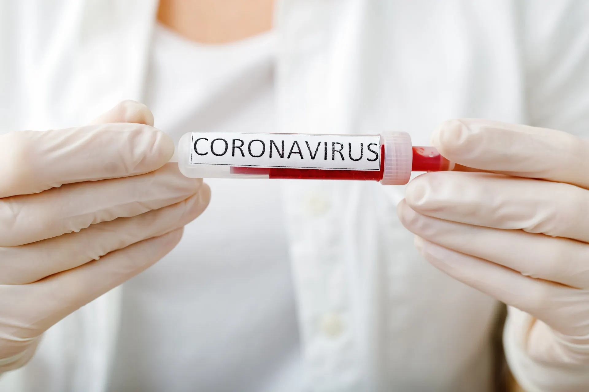 coronavirus