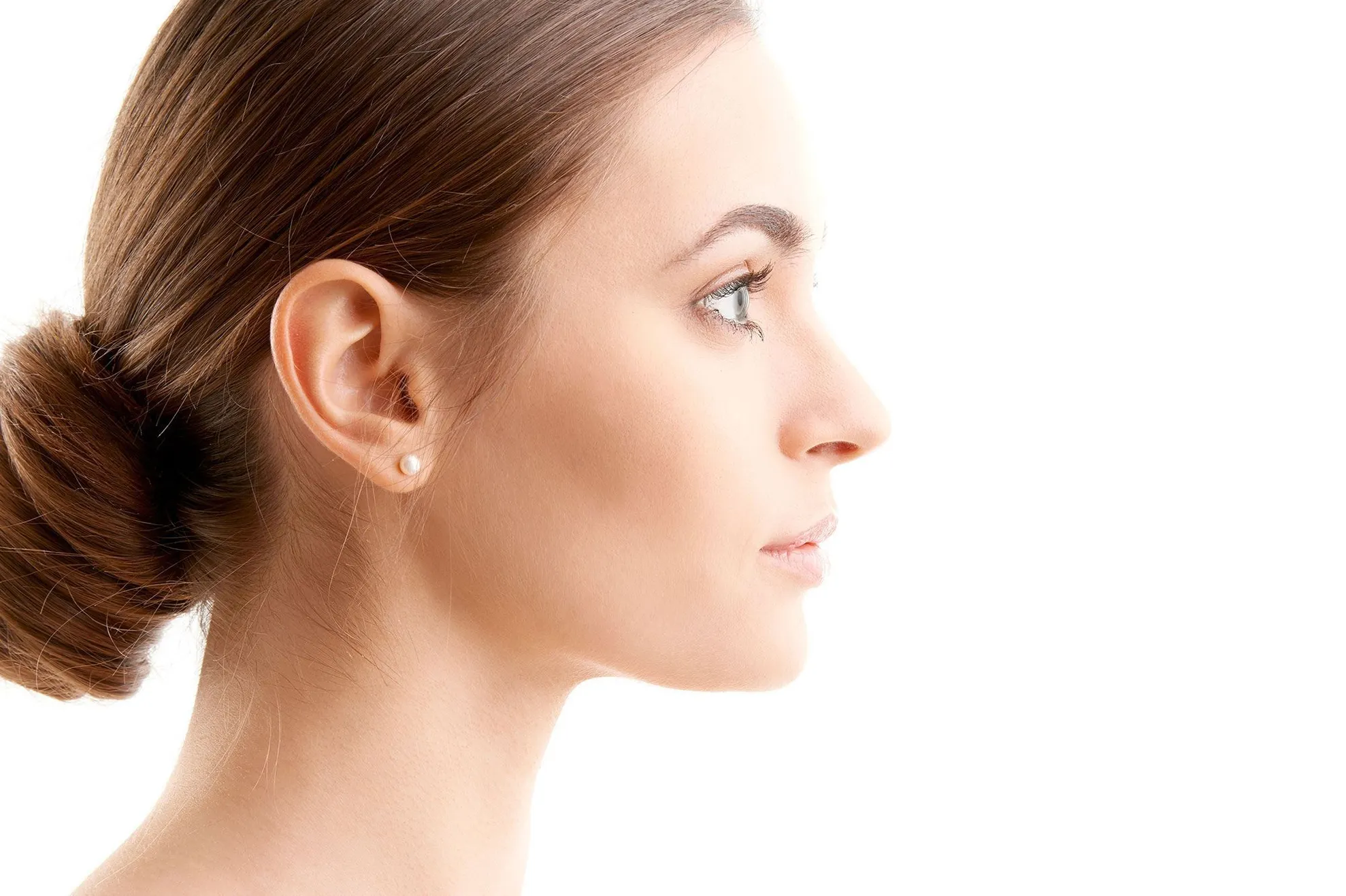 Profiloplastia