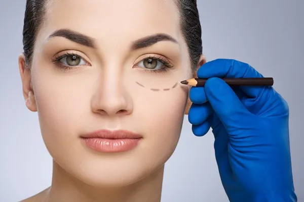 Blefaroplastia cosmetică
