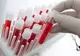Un test de sânge ar putea detecta cancerul mamar cu cinci ani înaintea primelor simptome
