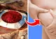 7 alimente care luptă împotriva celulitei, care chiar funcționează