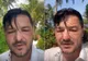 Liviu Vârciu a scăpat de fața umflată cu un remediu naturist